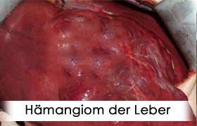 Hämangiom-der-Leber-menu